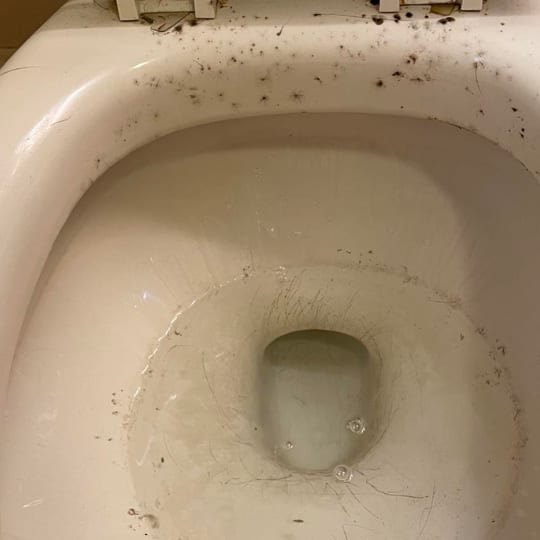 Toilet Bowl before cleaning